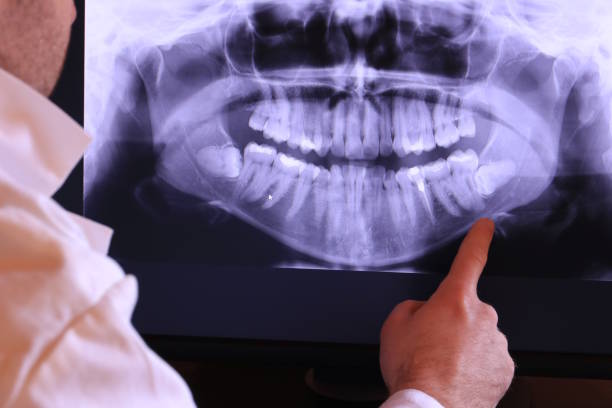 Best Broken or Cracked Tooth Emergency Dentist in New Paris, OH