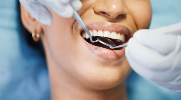 Best Emergency Dental Care for Abscessed Tooth in New Paris, OH