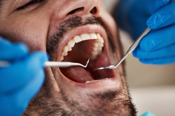 Best Emergency Dentist for Knocked-Out Tooth in New Paris, OH